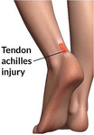 Podkolanówki jeździeckie z żelem ochronnym na ściegno Kentucky Ridingwear Achilles Gel 